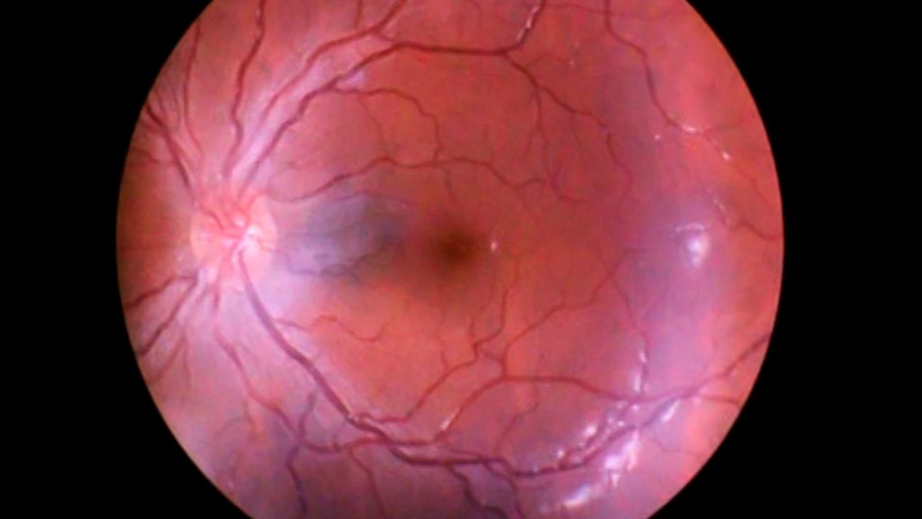 Photo 5 Stills_4_A_d__nde_van_los_p__jaros_cuando_llueve